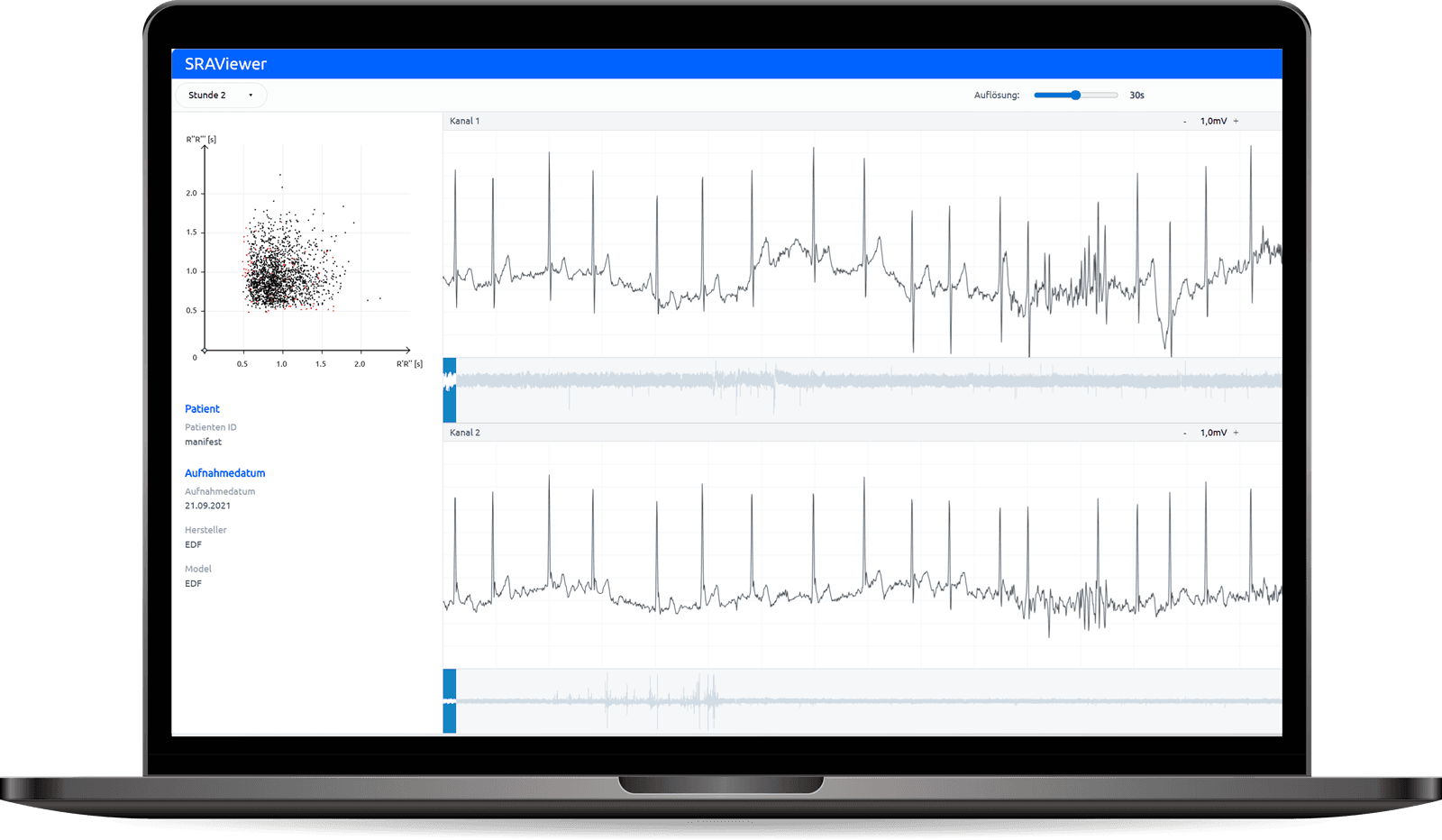 Apoplex product screenshot